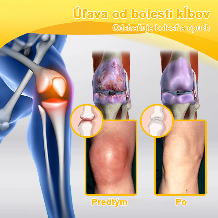 🎁🌿🎁 Zostáva už len 5 krabíc! Ponúkame vám dodatočnú zľavu 50 %! Urobte svoje telo zdravším. Ak to nestihnete teraz, dostanete to až na budúci rok.