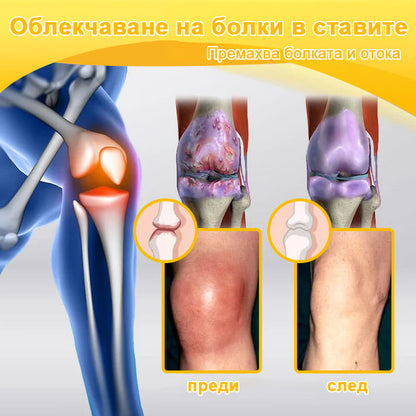 ❤️Bearnica™ Крем за стави с пчелен отров и куркума(👩‍🔬Специализиран за ортопедични заболявания и ставни болки👩‍🔬) (Copy)