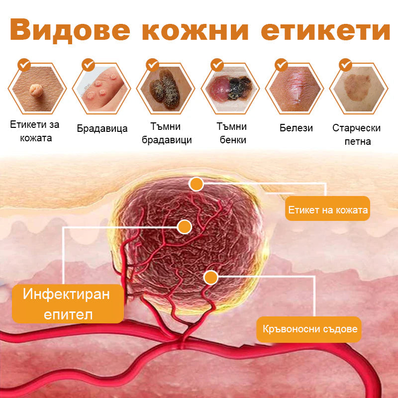 👑𝐁𝐞𝐧𝐞𝐭𝐮𝐫𝐞™ Крем за Премахване на Брадавици и Бенки с Пчелен Отров (🔥Последен ден на промоцията - 𝟖𝟎% отстъпка)