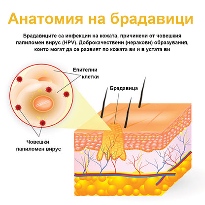 👑𝐁𝐞𝐧𝐞𝐭𝐮𝐫𝐞™ Крем за Премахване на Брадавици и Бенки с Пчелен Отров (🔥Последен ден на промоцията - 𝟖𝟎% отстъпка)