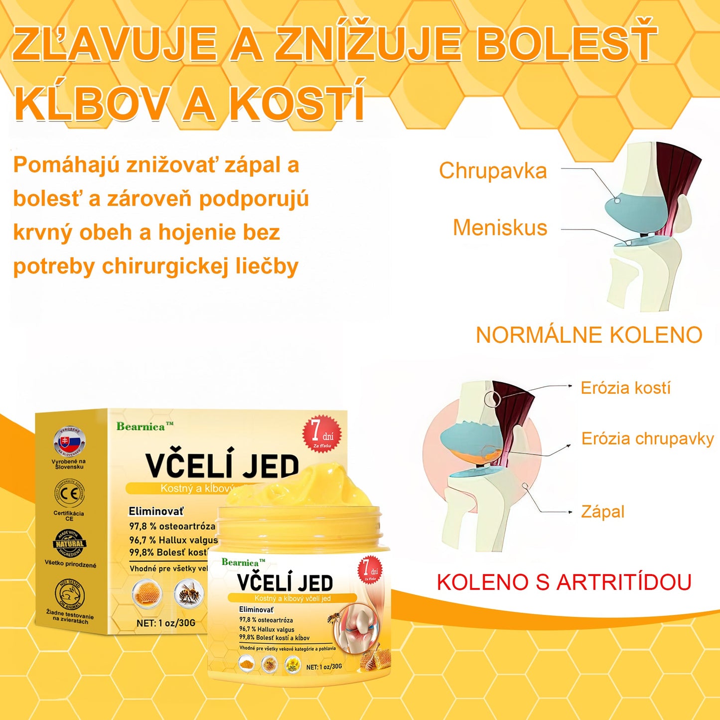 🐝🌿🐝𝐁𝐞𝐚𝐫𝐧𝐢𝐜𝐚™ 𝐊𝐫é𝐦 𝐧𝐚 𝐏𝐨𝐤𝐫𝐨č𝐢𝐥ú 𝐓𝐞𝐫𝐚𝐩𝐢𝐞 𝐊ĺ𝐛𝐨𝐯 𝐚 𝐊𝐨𝐬𝐭í 𝐬 𝐕č𝐞𝐥í𝐦 𝐉𝐞𝐝𝐨𝐦 (𝐍𝐨𝐯𝐨𝐳é𝐥𝐚𝐧𝐝𝐬𝐤ý 𝐯č𝐞𝐥í 𝐞𝐱𝐭𝐫𝐚𝐤𝐭 - Š𝐩𝐞𝐜𝐢𝐚𝐥𝐢𝐳𝐮𝐣𝐞 𝐬𝐚 𝐧𝐚 𝐨𝐫𝐭𝐨𝐩𝐞𝐝𝐢𝐜𝐤é 𝐨𝐜𝐡𝐨𝐫𝐞𝐧𝐢𝐚 𝐚 𝐛𝐨𝐥𝐞𝐬ť 𝐩𝐫𝐢 𝐚𝐫𝐭𝐫𝐢𝐭í𝐝𝐞)